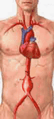 腹部大動脈瘤の図