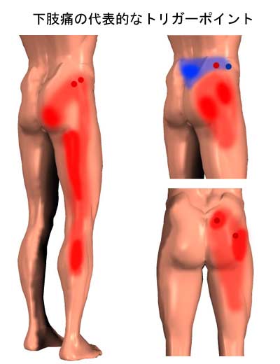 �����ɂ̃g���K�[�|�C���g