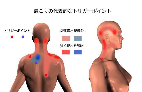 ������̃g���K�[�|�C���g