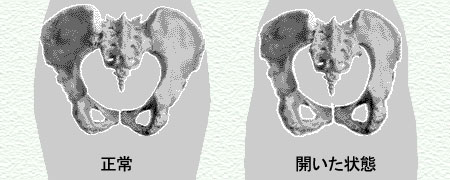 ���Ց̑��O�r�̑��`���Ղ̘c�݁`